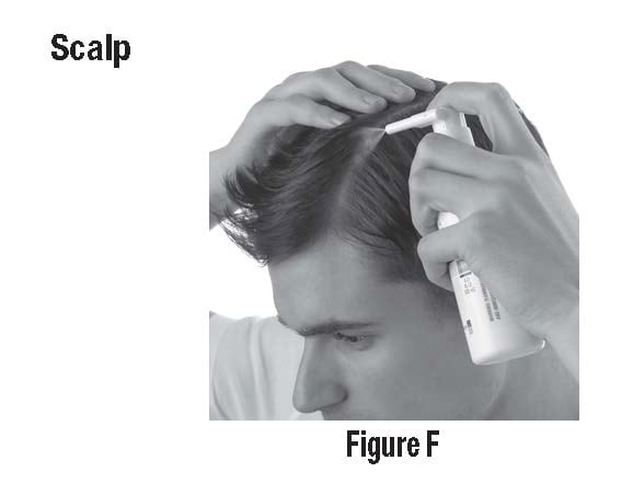 Figure F - Part your hair when applying to your scalp. Spray on to the affected area then rub in gently and completely.