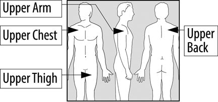 Place your Emsam transdermal system (patch) on your upper arm, upper chest, upper back or upper thigh.