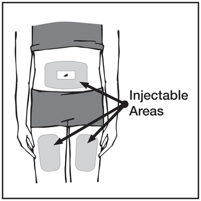 Injection sites include the front of the thighs and on the abdomen, but not within 2 inches of your belly button.