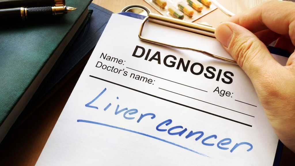 Liver cancer words on notepad