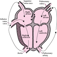 Transposition of the Great Arteries - Children's Health Issues ...